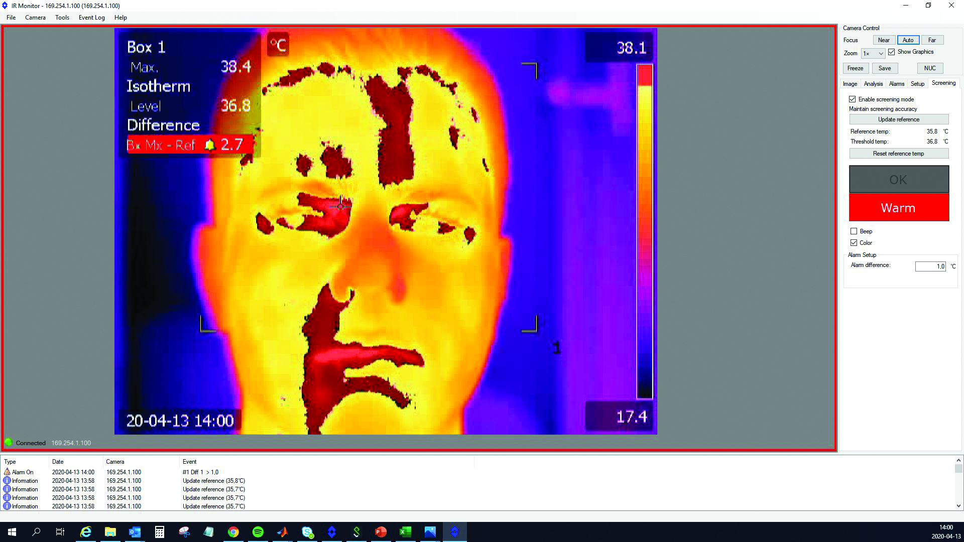 Thermal imaging to screen for elevated skin temperature
